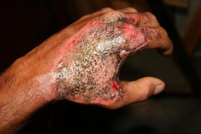 post-12379-0-45351700-1372308715_thumb.j