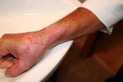 post-12379-0-97427000-1372730012_thumb.j